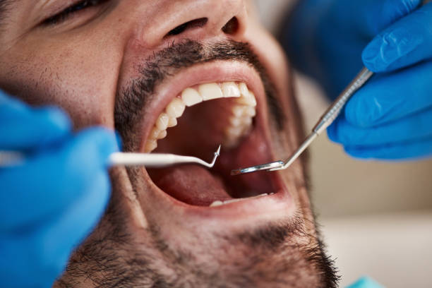 Best Emergency Cosmetic Dentistry in Truckee, CA