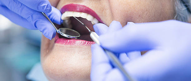 Best Emergency Dentist for Lost Fillings or Crowns in Truckee, CA